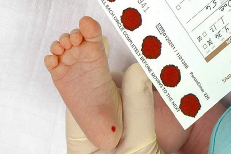 APAE inicia 2026 com a oferta gratuita do ‘Teste do Pezinho Ampliado’ pelo SUS